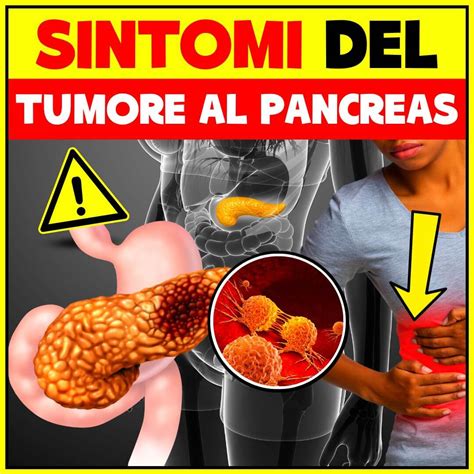 testimonianze sintomi tumore pancreas
